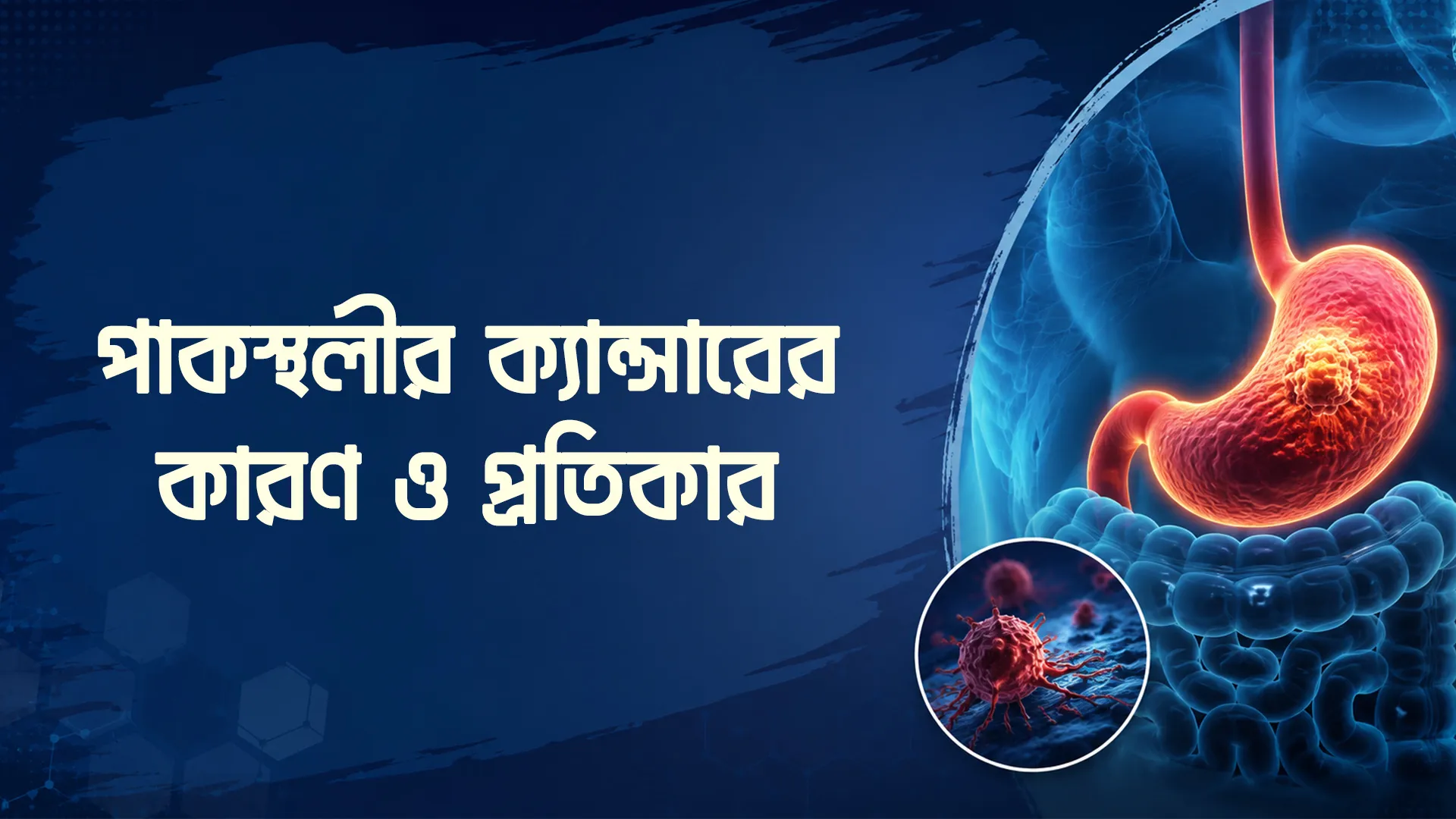 পাকস্থলীর ক্যান্সারের কারণ ও প্রতিকার | কোন লক্ষণগুলো অবহেলা করবেন না?