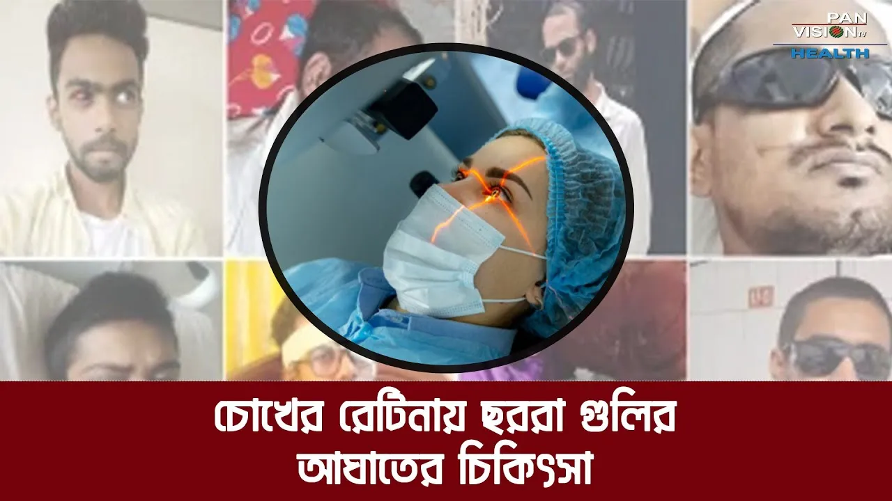 চোখের রেটিনায় ছররা গুলির আঘাতের চিকিৎসা সম্ভব?